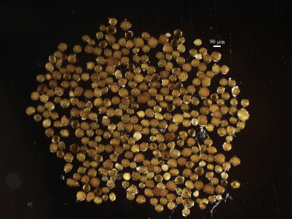 Entrophospora etunicata